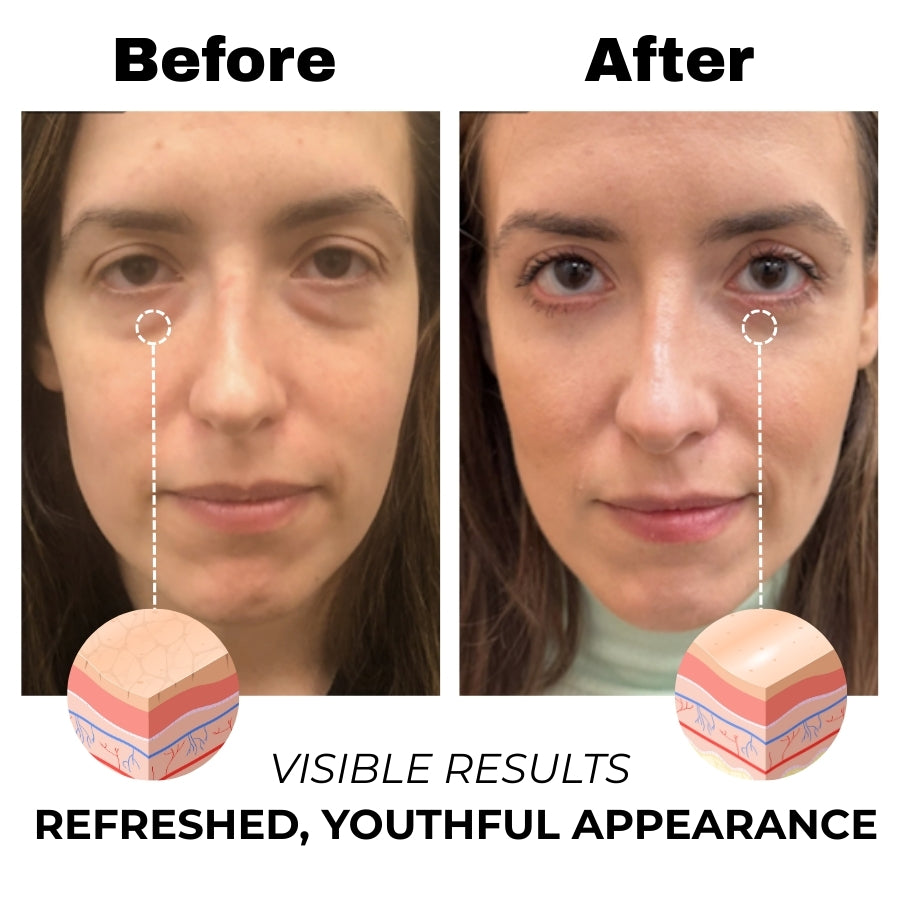 Coffee Eye Serum