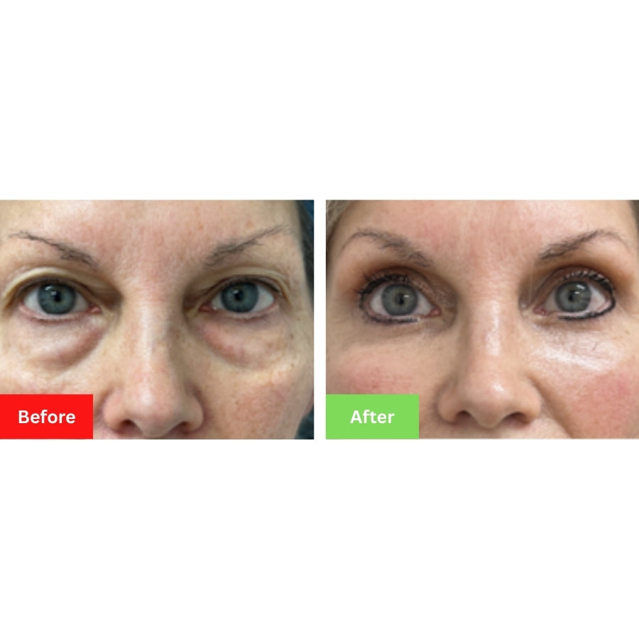Coffee Eye Serum