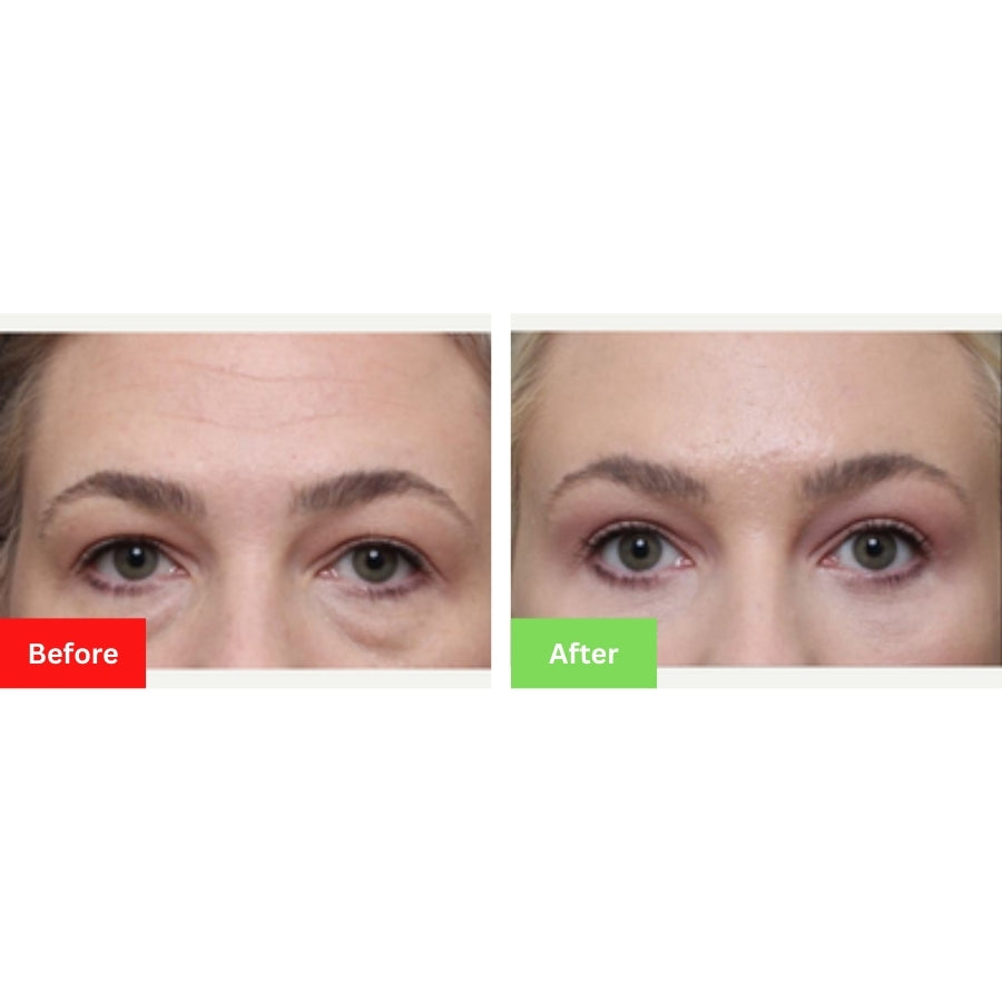 Coffee Eye Serum